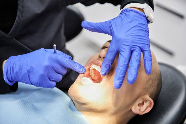 Best Emergency Root Canal Therapy in St George, SC